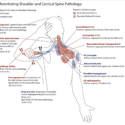 Summary Of Scapula Spine Pathologic Changes Download Scientific Diagram