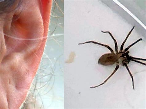 Brown Recluse Spider Found In Womans Ear