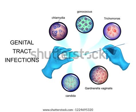 Vector Illustration Pathogens Sexually Transmitted Infections Stock