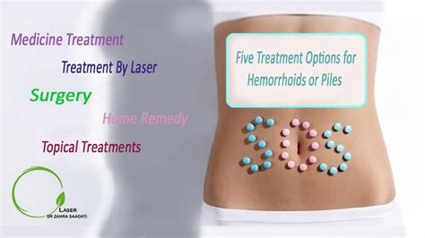 Five Treatment Options For Hemorrhoids Or Piles Dr Zahra Saadati