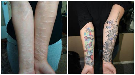 Russian Tattoo Artist Covers Up Domestic Abuse Scars For Free