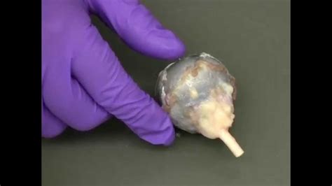 Fresh cow eye dissection (Part 1): Preparation - YouTube