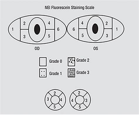 Optimizing The Ocular Surface