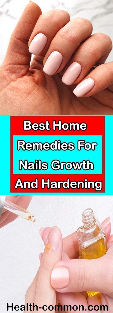 Top Best Home Remedies For Nails Make Your Nails Hard And Growing