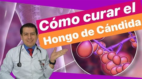 COMO CURAR EL HONGO DE CANDIDA Tratamiento Natural Contra La Candidiasis Dr Javier E Mo