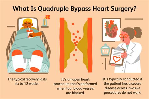 Quadruple Bypass Heart Surgery Process And Recovery