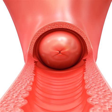 Female Vagina And Cervix Photograph By Pixologicstudio Science Photo Library