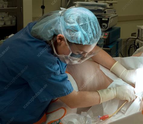 Foley Catheter Insertion Stock Image C Science Photo Library