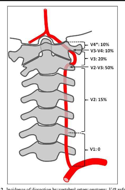 Vertebral Artery Anatomy Anatomical Charts And Posters