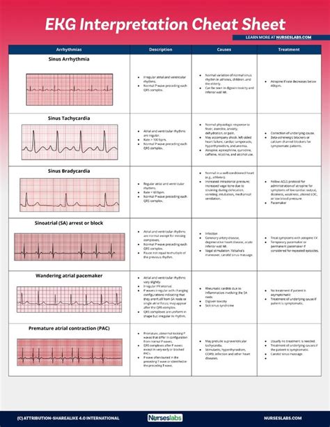 Use This EKG Interpretation Cheat Sheet That Summarizes All Heart Arrhythmias In An Easy To