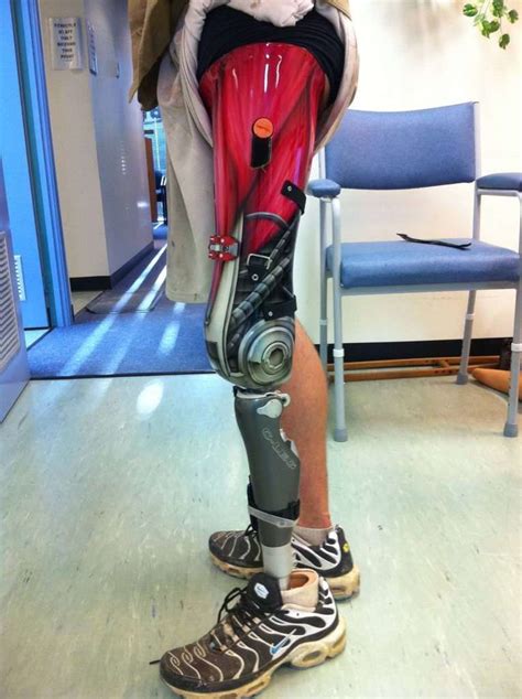 fashion focused prosthetics orthotics and prosthetics prosthetic leg prosthetics