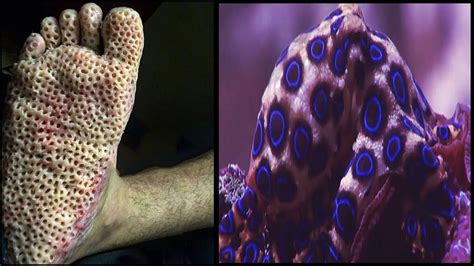 Film semi, semi, semi thailand, watch. Blue Ringed Octopus Facts | Venomous Ocean Animals Mini ...