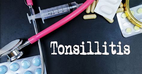 10 Symptoms And Causes Of Tonsillitis Facty Health