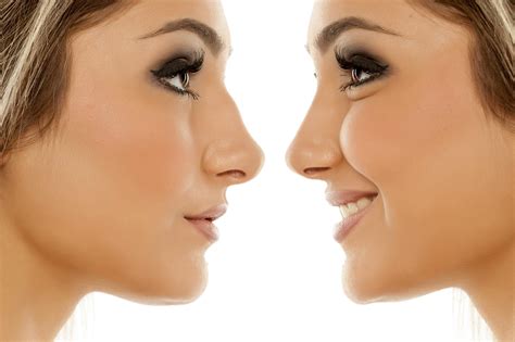 How To Make Your Nose Sharper Nose Reshape Exercises Can Help Improve
