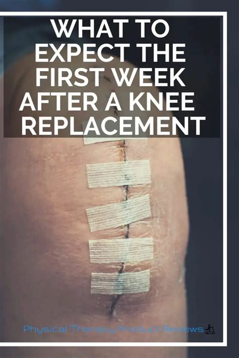 What To Expect In Your First Week After A Total Knee Replacement Best
