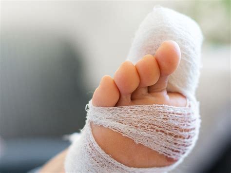 The most common complication of a broken toe is trauma to the toenail of the affected toe. Broken toe - Doctor who