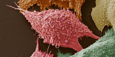 Typical causes of carcinophobia include a brush with the disease; What do cancer cells eat? | eLife Science Digests | eLife