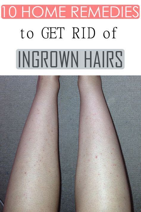 How To Exfoliate Legs To Remove Ingrown Hairs 214 Best Hair Ideas