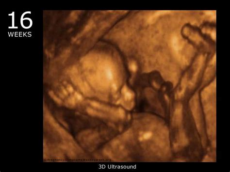 3d Ultrasound At 16 Weeks Pregnant During The 16th Week Of Pregnancy