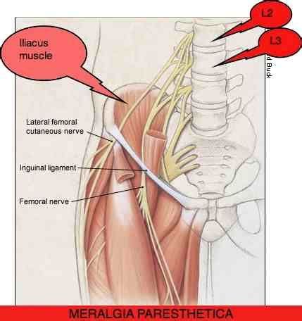 Iliopsoas muscle, a hip flexor muscle that attaches to the upper thigh bone. Pin on Back Pain