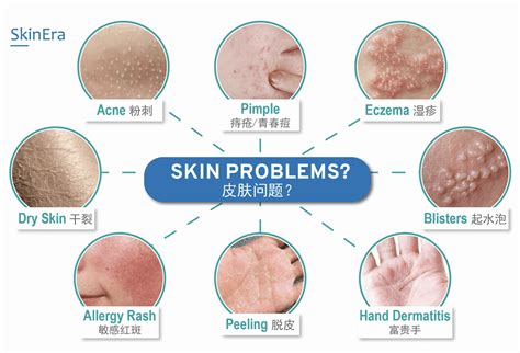 6 Signs You Have Sensitive Skin Prevention And Care Urban Ladies