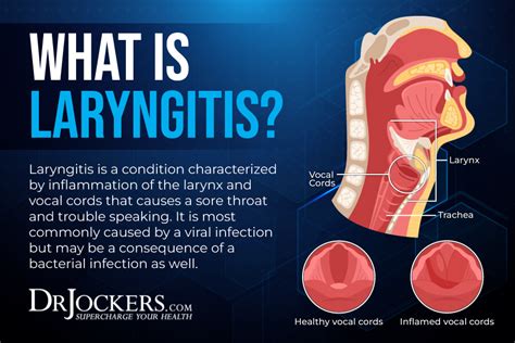 Laryngitis Symptoms And Natural Support Strategies
