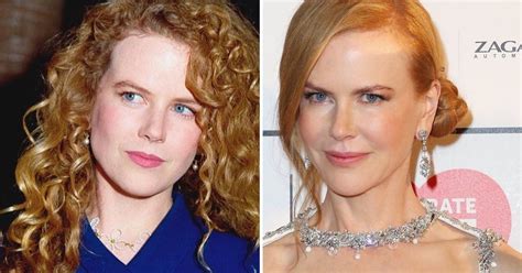 What Changes Did Nicole Kidman Make To Her Face