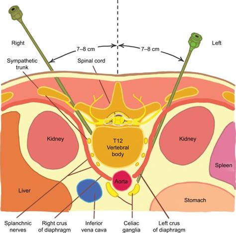 Solar Plexus Anatomy Anatomical Charts And Posters