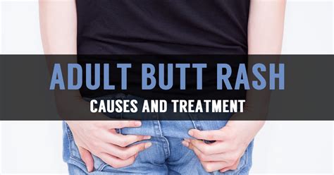 Learn About Adult Butt Rash And Its Treatment