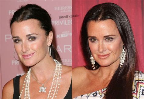See Real Housewives Of Beverly Hills Cast Member Kyle Richards Before
