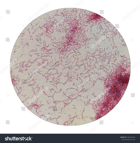 Tinción Endospora De La Célula Bacillus Foto De Stock 1884263203