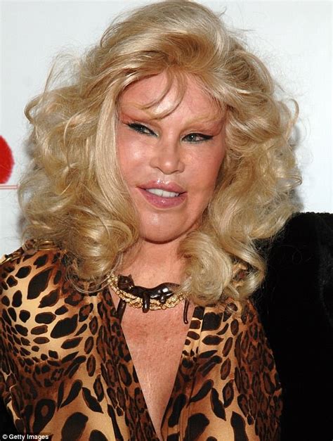 Who Is Jocelyn Wildenstein ‘catwoman Socialite Who Filed For