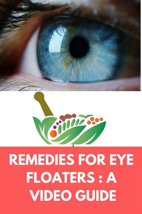 Remedies For Eye Floaters Simple Video Guide Remedies Eye Floaters
