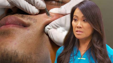 10 Times Dr Pimple Popper Had Things Go Horribly Wrong Youtube