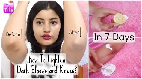 How To Lighten Dark Elbows And Knees In 7 Days Riya Beauty Youtube