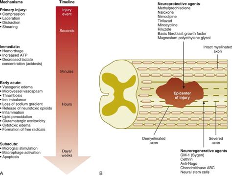 The Timing Of Management Of Spinal Cord Injuries Musculoskeletal Key