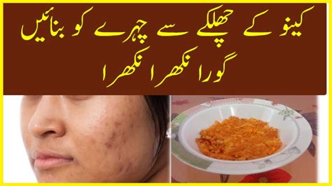Pigmentation Treatment At Home In Urdu Orange Peel For Skin Glowing