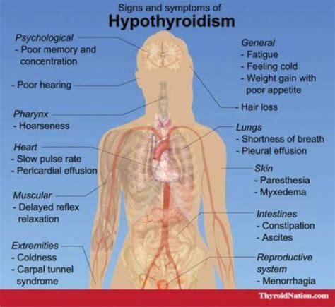 Hyperthyroidism Signs And Symptoms My XXX Hot Girl