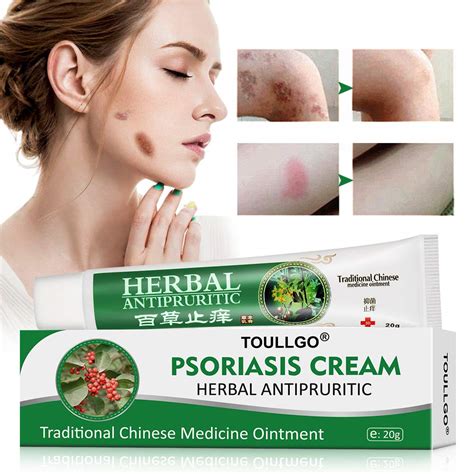 Buy Psoriasis Cream Psoriasis Seborrheic Dermatitis Cream Chinese