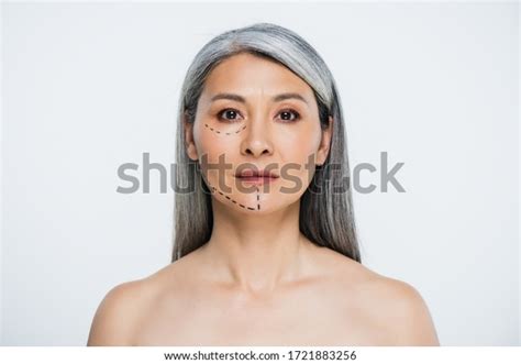 Attractive Naked Asian Woman Plastic Surgery Stock Photo 1721883256