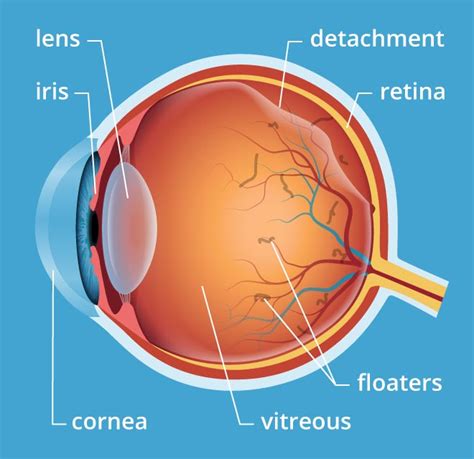 Naturally, the whites of the eyes consist of bright sclerotic coat that protects the external part of the eyeball. Flashes, Floaters, and Vitreous Detachment | Fishbaugh ...