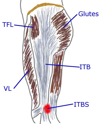 Iliotibial Band Syndrome Itbs Running Tips