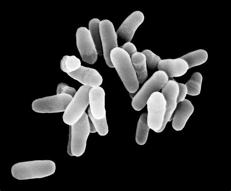 Mycobacterium Tuberculosis Photograph By Dennis Kunkel Microscopy