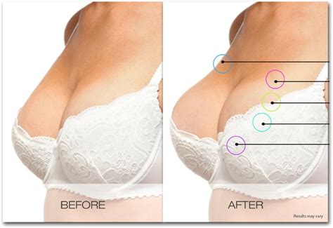 get a bigger bust and increase breast size without surgery with bolero natural breast