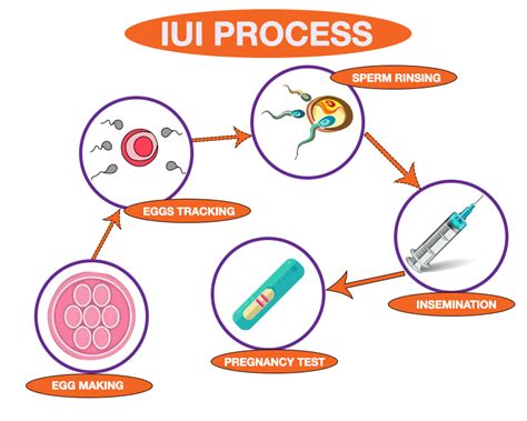 Get The Best Iui Treatment India With High Success Rate