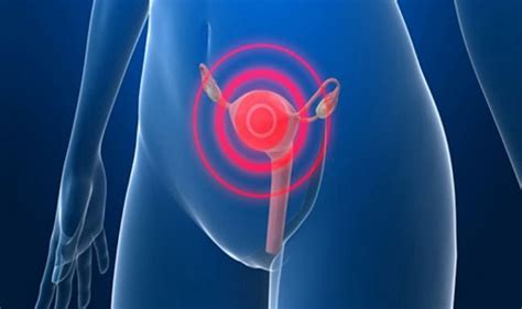 Păi, sunt multe feluri în care te poți îmbolnăvi de cancer. cáncer de cuello de útero
