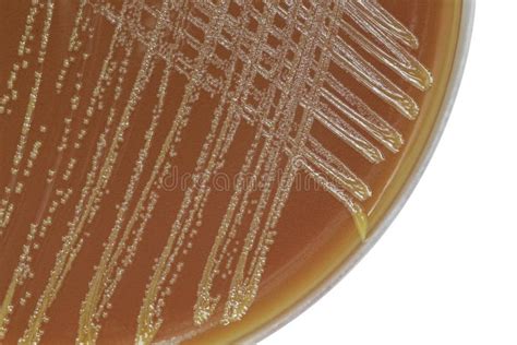 Neisseria Bacterial Colonies On Chocolate Agar Plate Stock Photo
