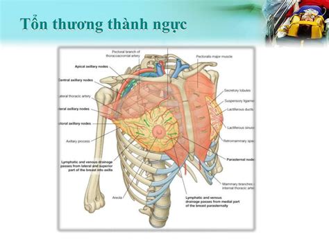 PPT Chấn thương ngực PowerPoint Presentation free download ID 5141845