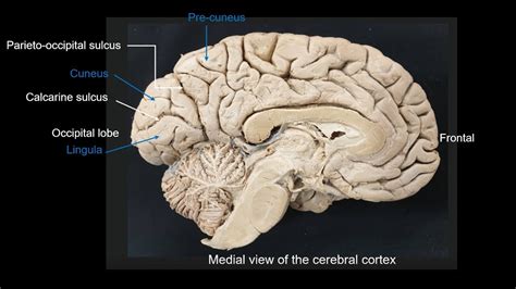 Parieto Occipital And Calcarine Sulci Cuneus And Lingual Gyri And Pre