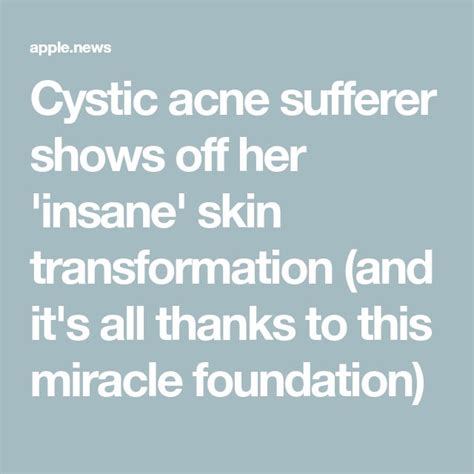 Cystic Acne Sufferer Shows Off Her Insane Skin Transformation And It S All Thanks To This